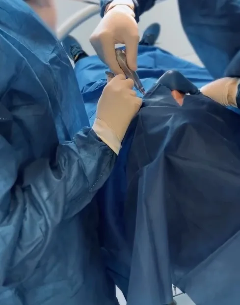 Implantes dentários na Clínica Ehlers